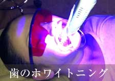 ホワイトニング